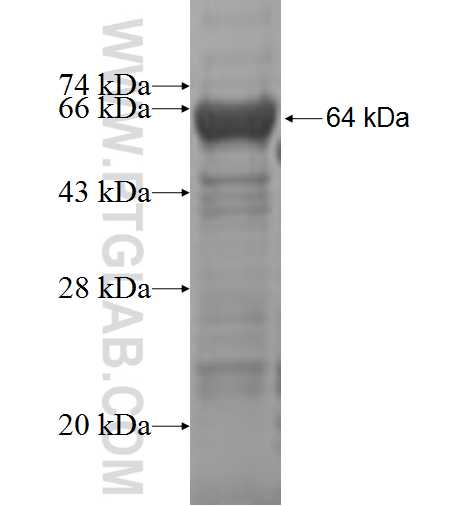 PSMD11 fusion protein Ag6435 SDS-PAGE