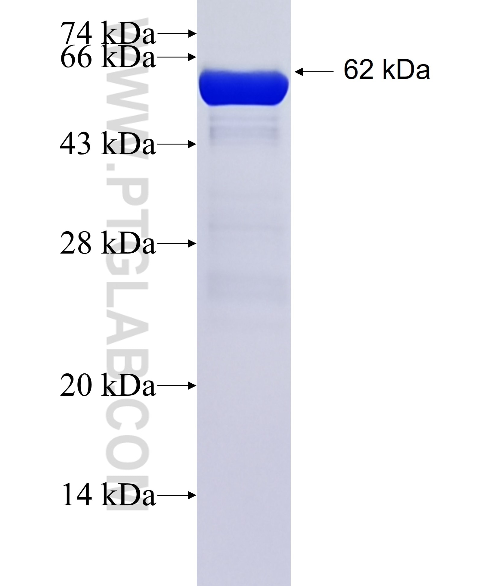 PSMD11 fusion protein Ag6435 SDS-PAGE