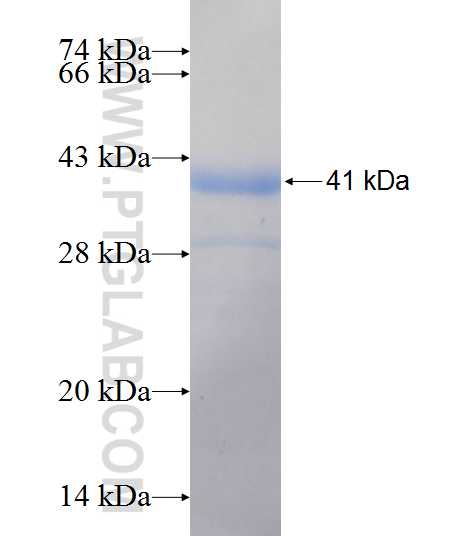 PSMD11 fusion protein Ag6879 SDS-PAGE