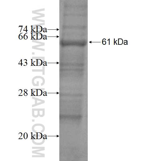 PSMD12 fusion protein Ag1957 SDS-PAGE