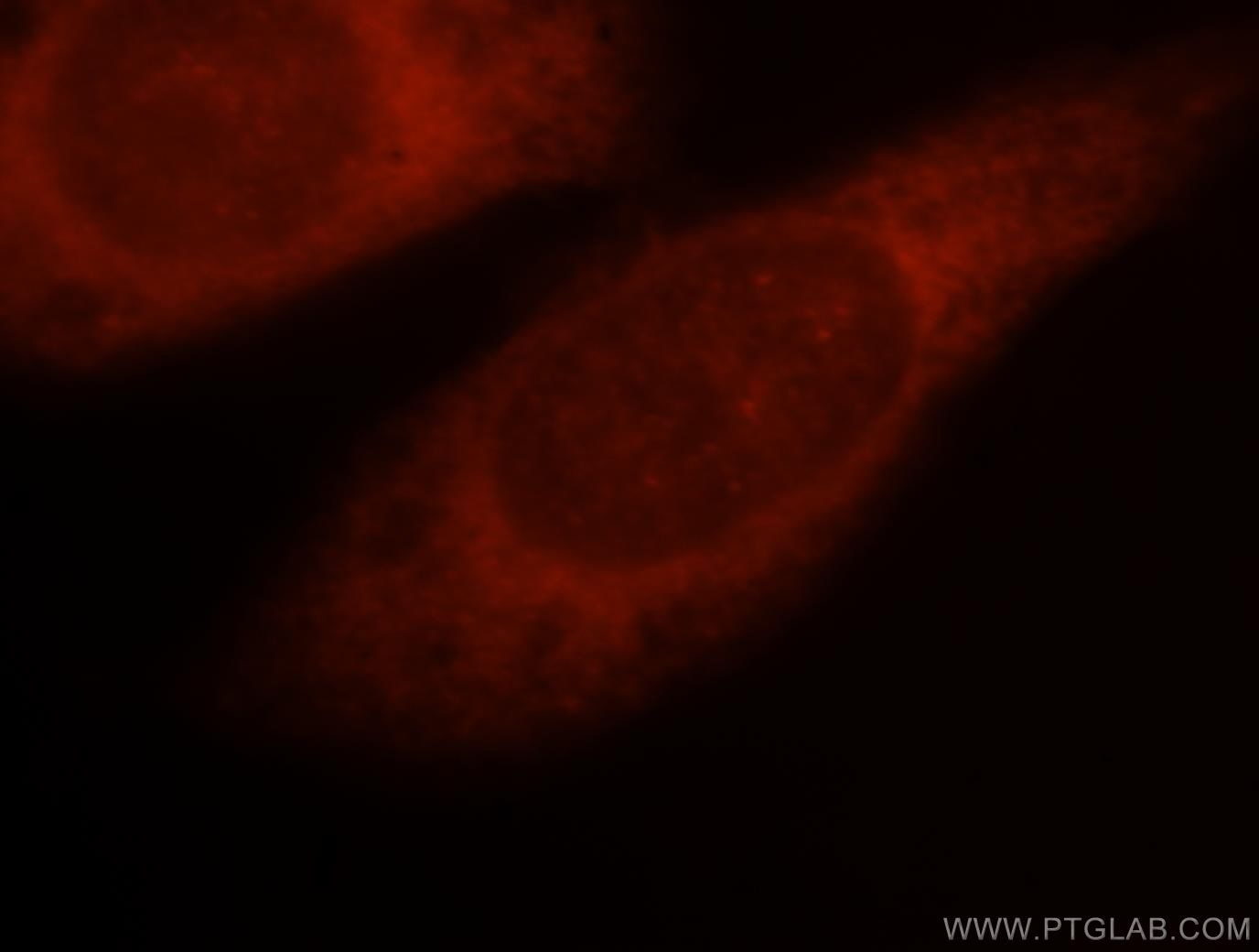 Immunofluorescence (IF) / fluorescent staining of HeLa cells using PSMD13 Polyclonal antibody (15261-1-AP)