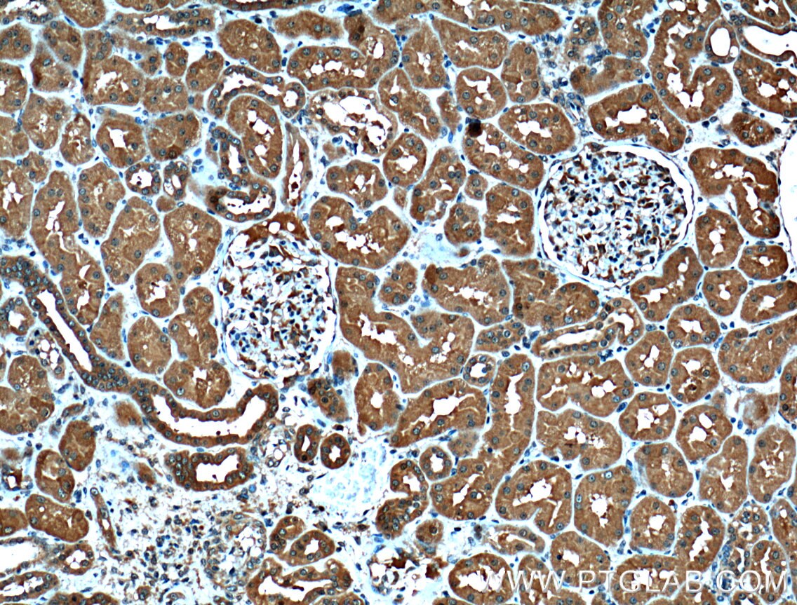 Immunohistochemistry (IHC) staining of human kidney tissue using PSMD13 Polyclonal antibody (15261-1-AP)