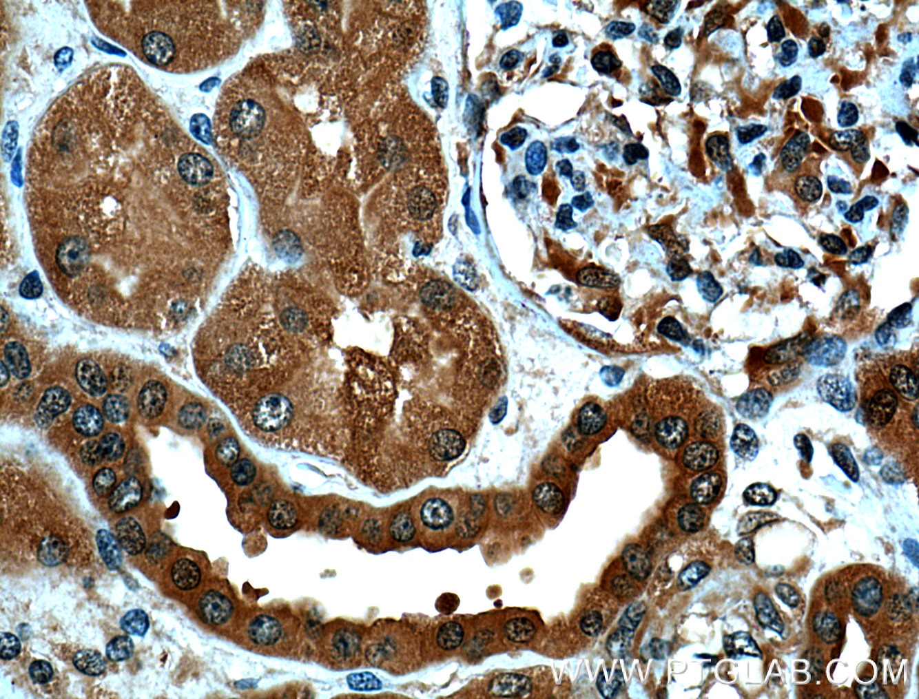 Immunohistochemistry (IHC) staining of human kidney tissue using PSMD13 Polyclonal antibody (15261-1-AP)
