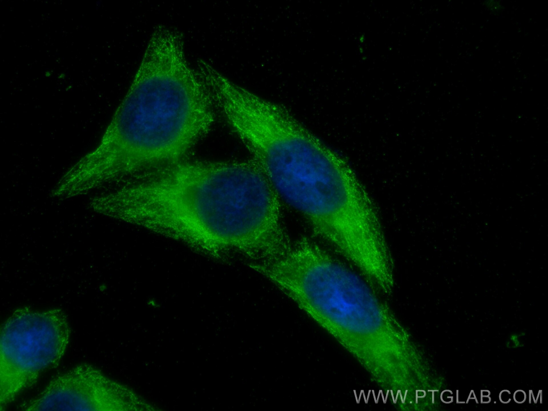 Immunofluorescence (IF) / fluorescent staining of HepG2 cells using PSMD13 Monoclonal antibody (67807-1-Ig)