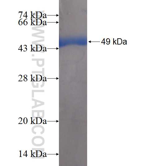 PSMD13 fusion protein Ag7857 SDS-PAGE