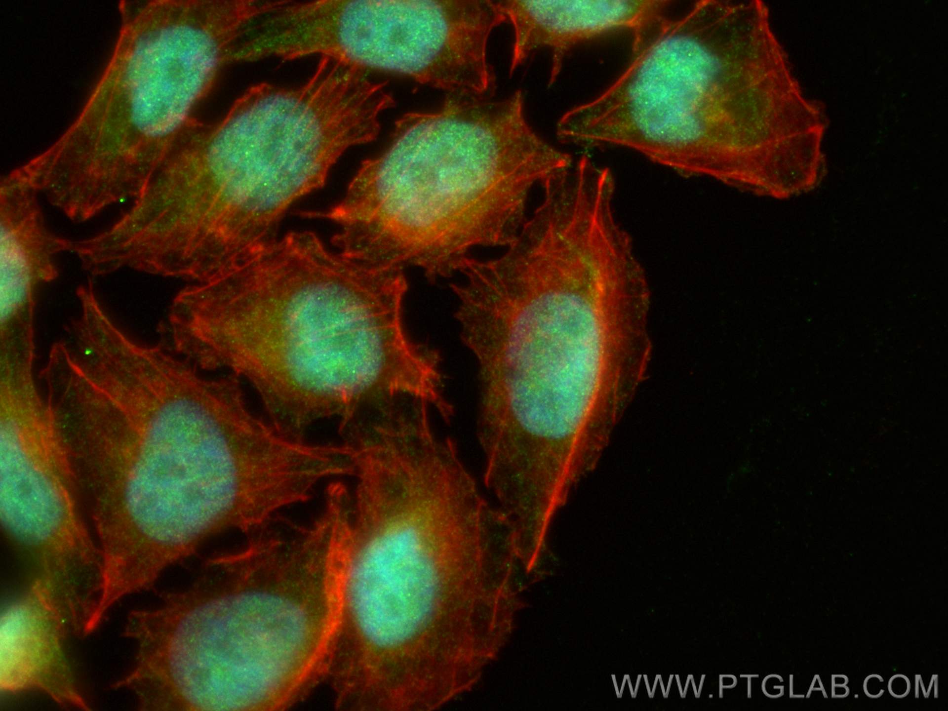 Immunofluorescence (IF) / fluorescent staining of A375 cells using PSMD14/POH1 Polyclonal antibody (12059-1-AP)