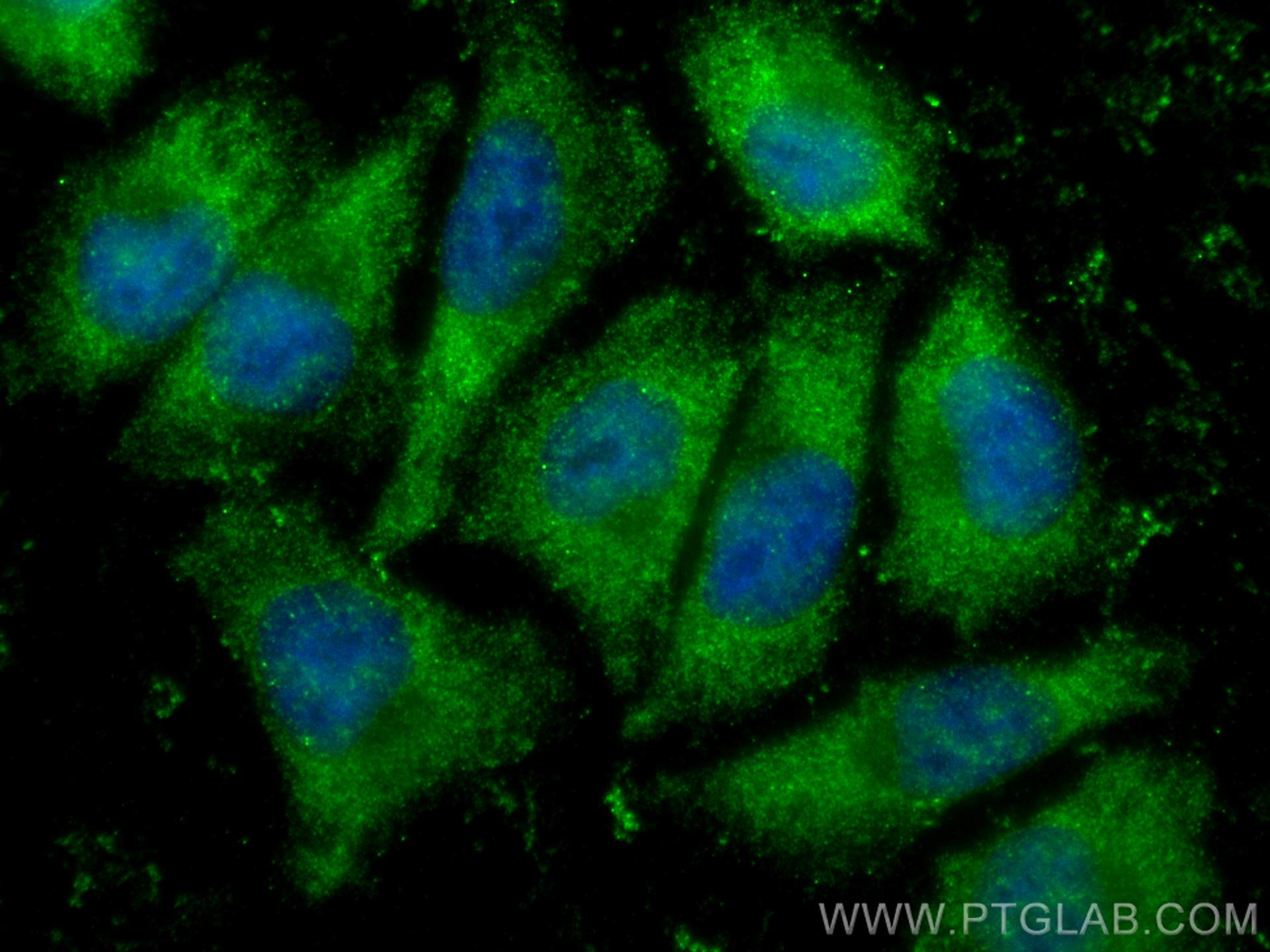 Immunofluorescence (IF) / fluorescent staining of A375 cells using PSMD14/POH1 Polyclonal antibody (12059-1-AP)
