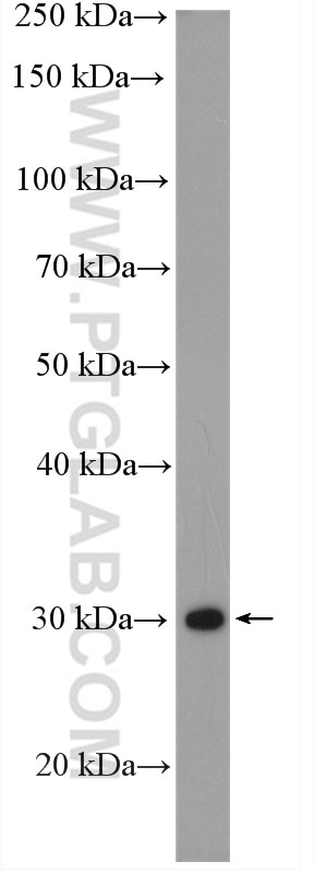 Western Blot (WB) analysis of A431 cells using PSMD14/POH1 Polyclonal antibody (12059-1-AP)