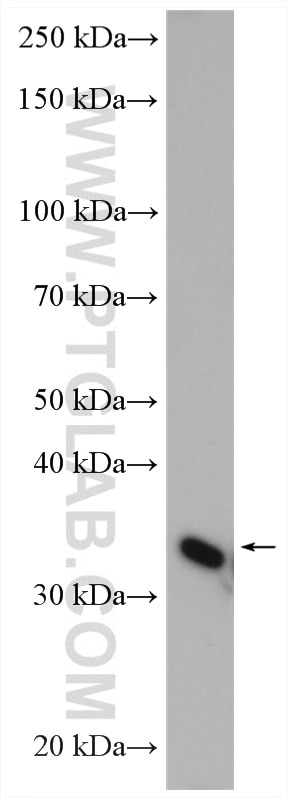 Western Blot (WB) analysis of rat heart tissue using PSMD14/POH1 Polyclonal antibody (12059-1-AP)