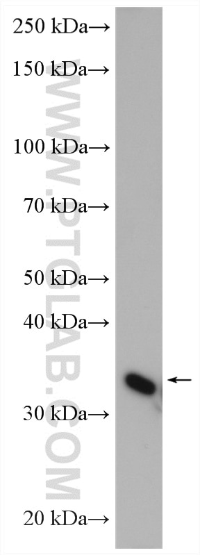 WB analysis of rat heart using 12059-1-AP