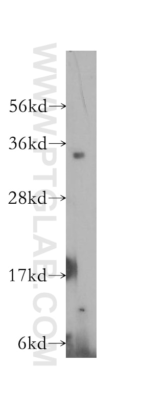 PSMD14/POH1 Polyclonal antibody