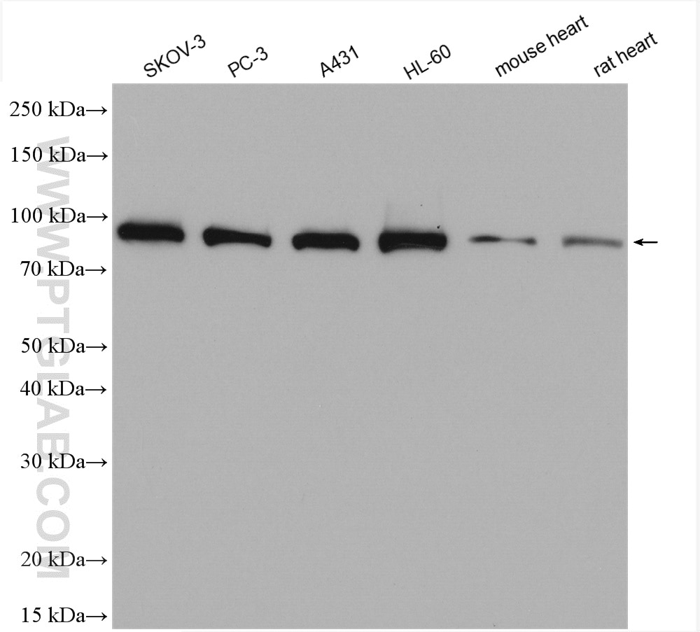 Western Blot (WB) analysis of various lysates using PSMD2 Polyclonal antibody (14748-1-AP)