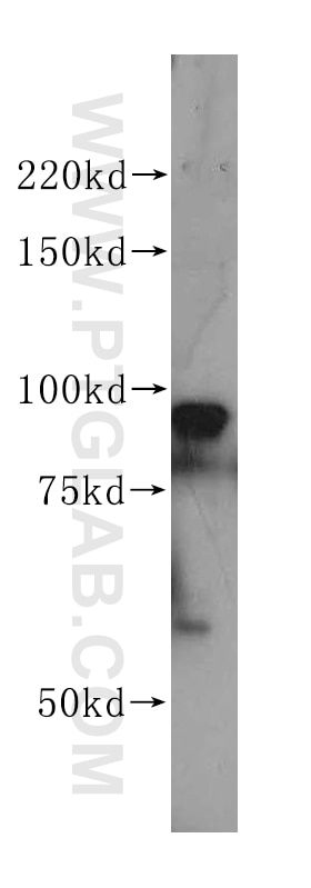 Western Blot (WB) analysis of HeLa cells using PSMD2 Polyclonal antibody (14748-1-AP)