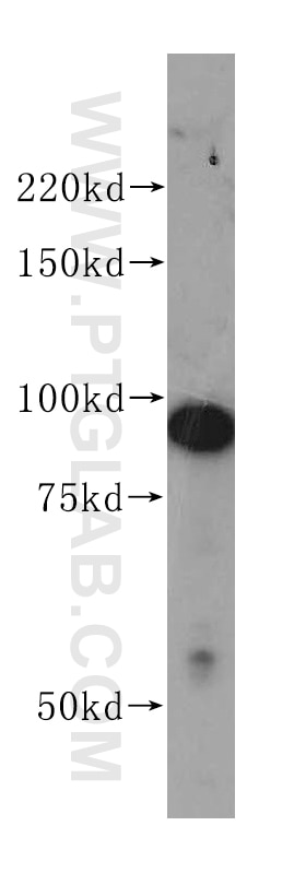 Western Blot (WB) analysis of K-562 cells using PSMD2 Polyclonal antibody (14748-1-AP)