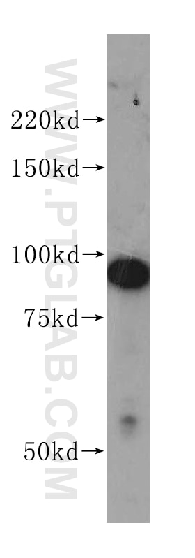 WB analysis of K-562 using 14748-1-AP