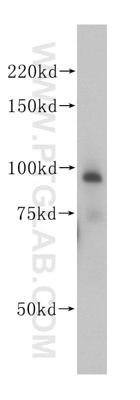 Western Blot (WB) analysis of human heart tissue using PSMD2 Polyclonal antibody (14748-1-AP)