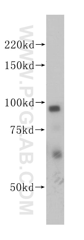 Western Blot (WB) analysis of mouse skeletal muscle tissue using PSMD2 Polyclonal antibody (14748-1-AP)