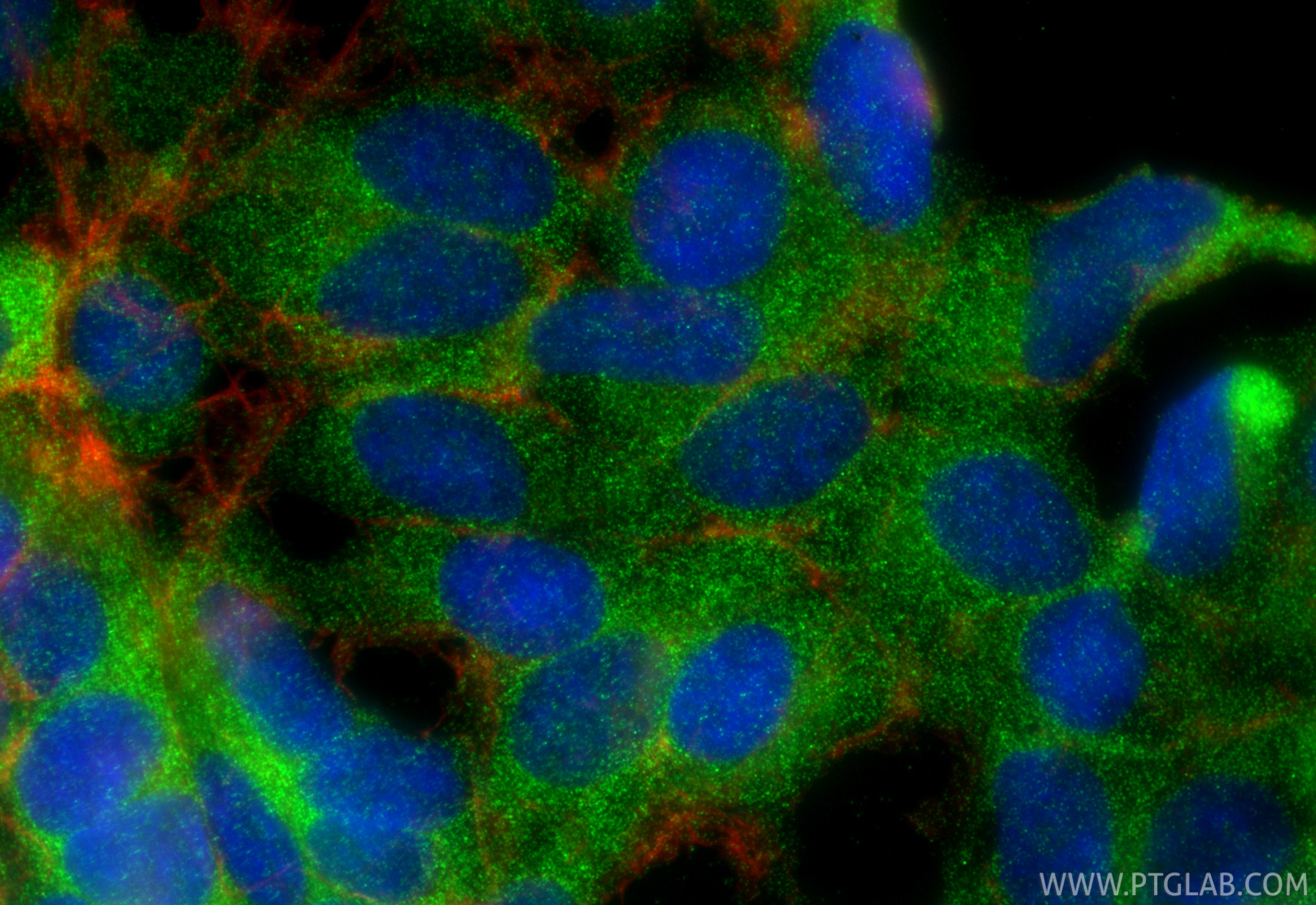 Immunofluorescence (IF) / fluorescent staining of HEK-293 cells using PSMD2 Monoclonal antibody (67770-1-Ig)