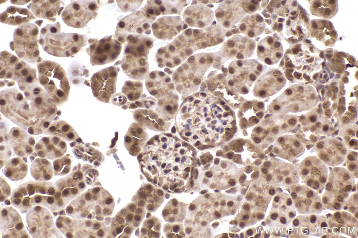 Immunohistochemistry (IHC) staining of mouse kidney tissue using PSMD2 Monoclonal antibody (67770-1-Ig)