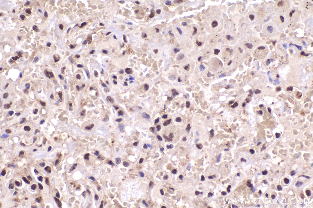 Immunohistochemistry (IHC) staining of human lung tissue using PSMD2 Monoclonal antibody (67770-1-Ig)