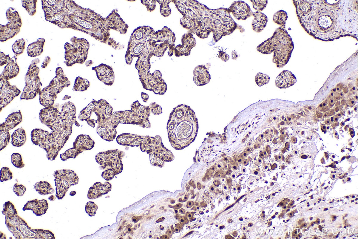 Immunohistochemistry (IHC) staining of human placenta tissue using PSMD2 Monoclonal antibody (67770-1-Ig)