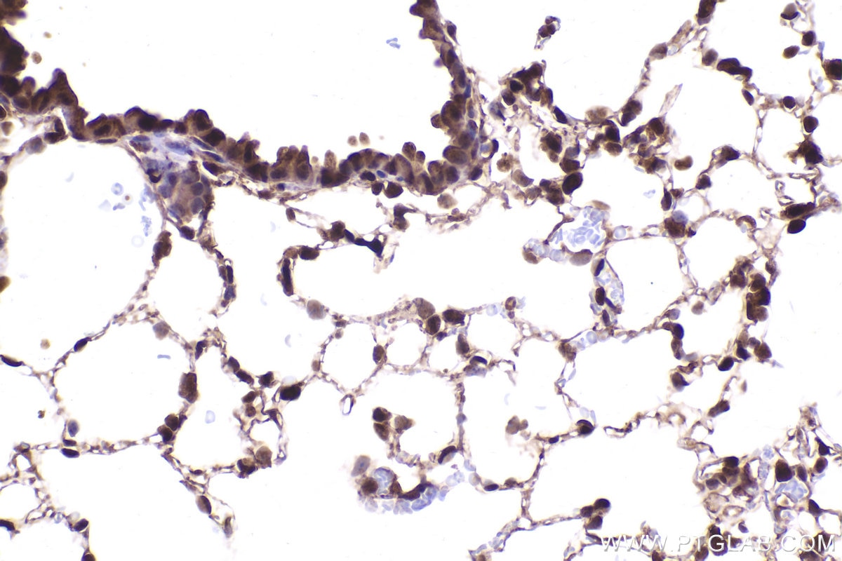 Immunohistochemistry (IHC) staining of mouse lung tissue using PSMD2 Monoclonal antibody (67770-1-Ig)