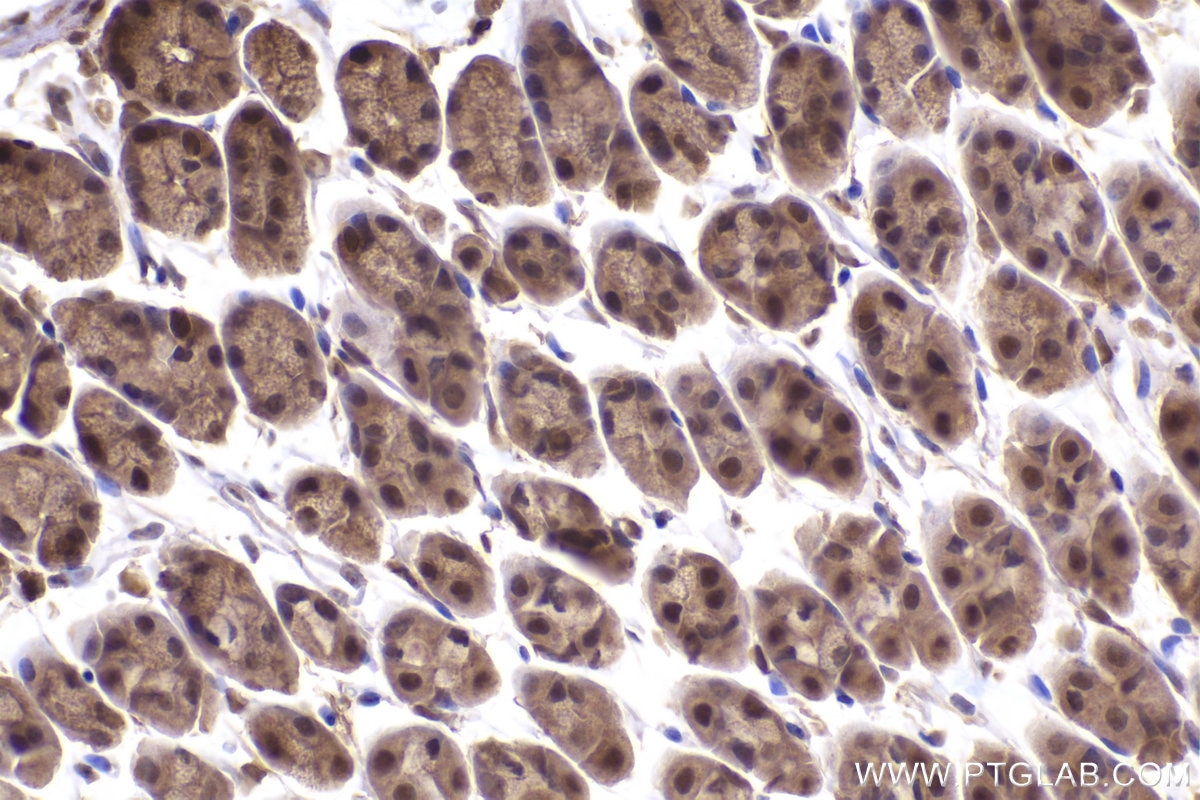 Immunohistochemistry (IHC) staining of mouse stomach tissue using PSMD2 Monoclonal antibody (67770-1-Ig)