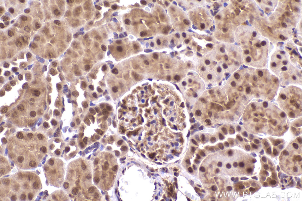 Immunohistochemistry (IHC) staining of rat kidney tissue using PSMD2 Monoclonal antibody (67770-1-Ig)
