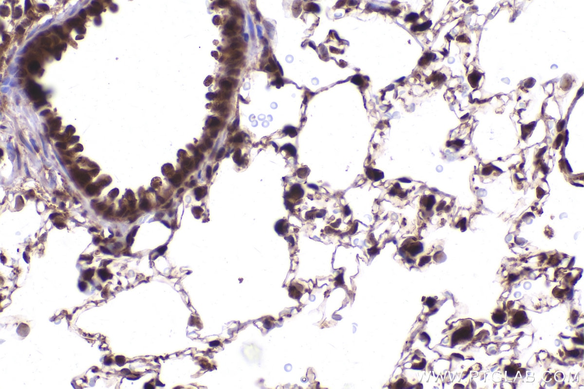 Immunohistochemistry (IHC) staining of rat lung tissue using PSMD2 Monoclonal antibody (67770-1-Ig)