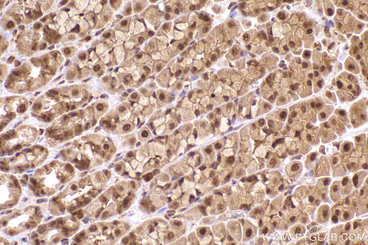 Immunohistochemistry (IHC) staining of rat stomach tissue using PSMD2 Monoclonal antibody (67770-1-Ig)