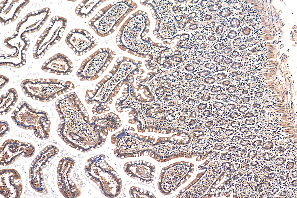 Immunohistochemistry (IHC) staining of human small intestine tissue using PSMD3 Polyclonal antibody (12054-1-AP)