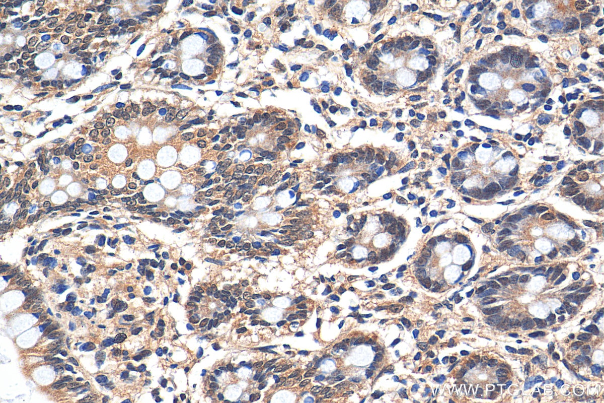 Immunohistochemistry (IHC) staining of human small intestine tissue using PSMD3 Polyclonal antibody (12054-1-AP)