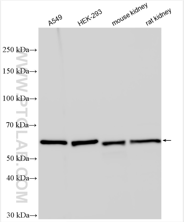 Western Blot (WB) analysis of various lysates using PSMD3 Polyclonal antibody (12054-1-AP)
