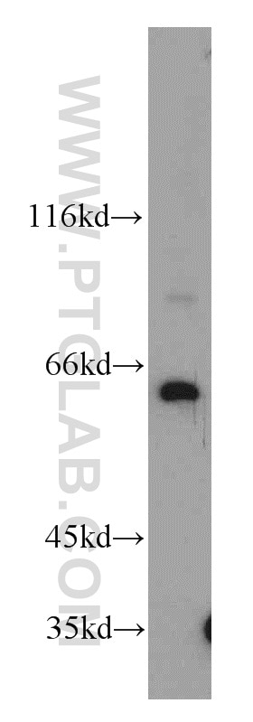Western Blot (WB) analysis of human brain tissue using PSMD3 Polyclonal antibody (12054-1-AP)