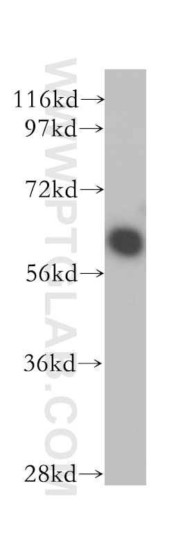 Western Blot (WB) analysis of mouse brain tissue using PSMD3 Polyclonal antibody (12054-1-AP)