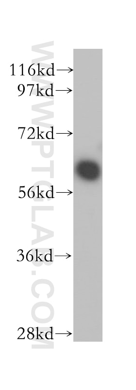 Western Blot (WB) analysis of mouse brain tissue using PSMD3 Polyclonal antibody (12054-1-AP)