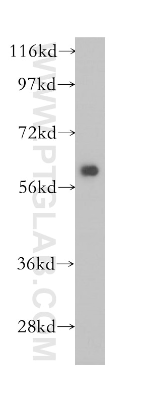 Western Blot (WB) analysis of human kidney tissue using PSMD3 Polyclonal antibody (12054-1-AP)