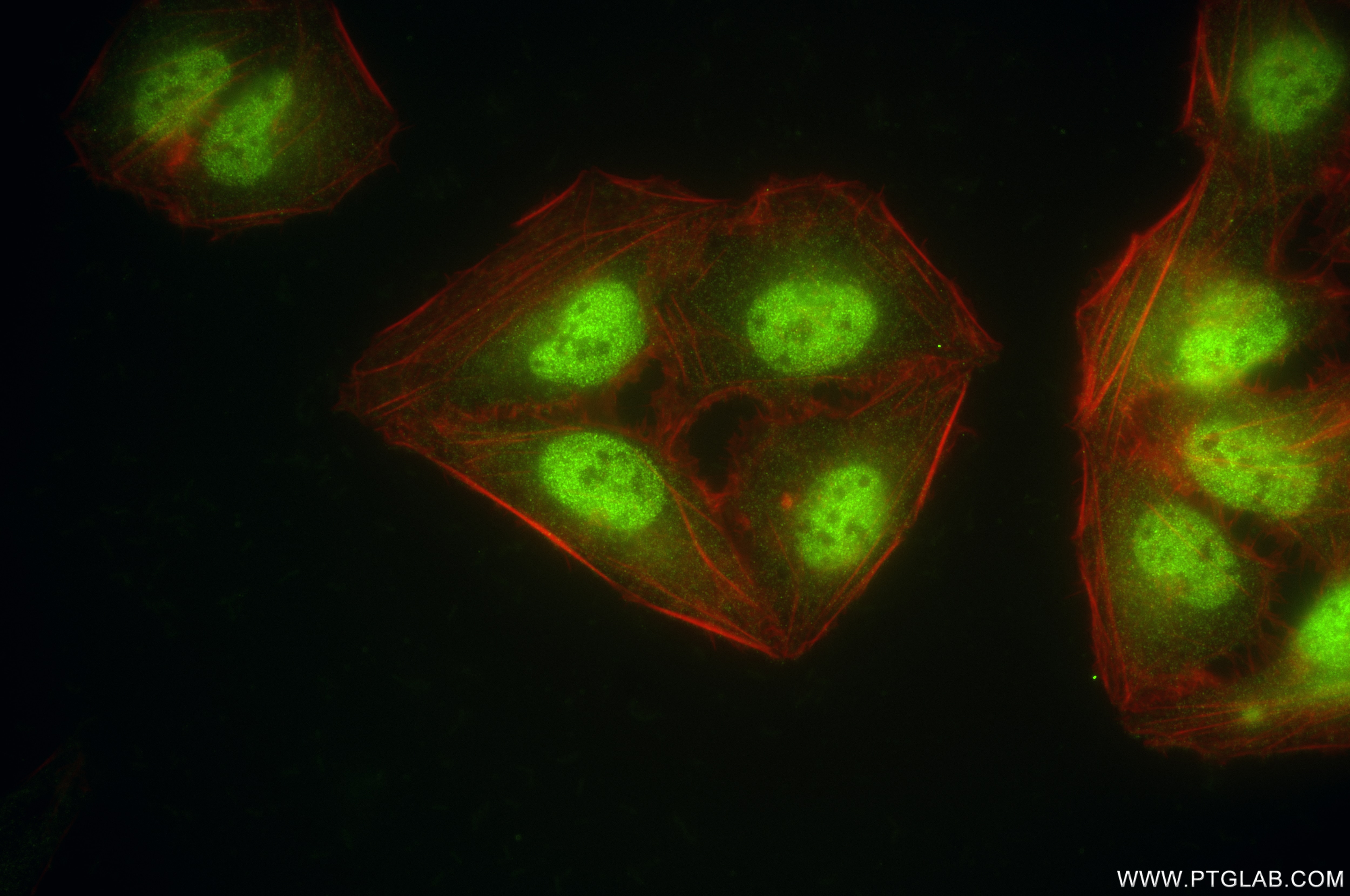 Immunofluorescence (IF) / fluorescent staining of U2OS cells using PSMD3 Recombinant antibody (84928-2-RR)