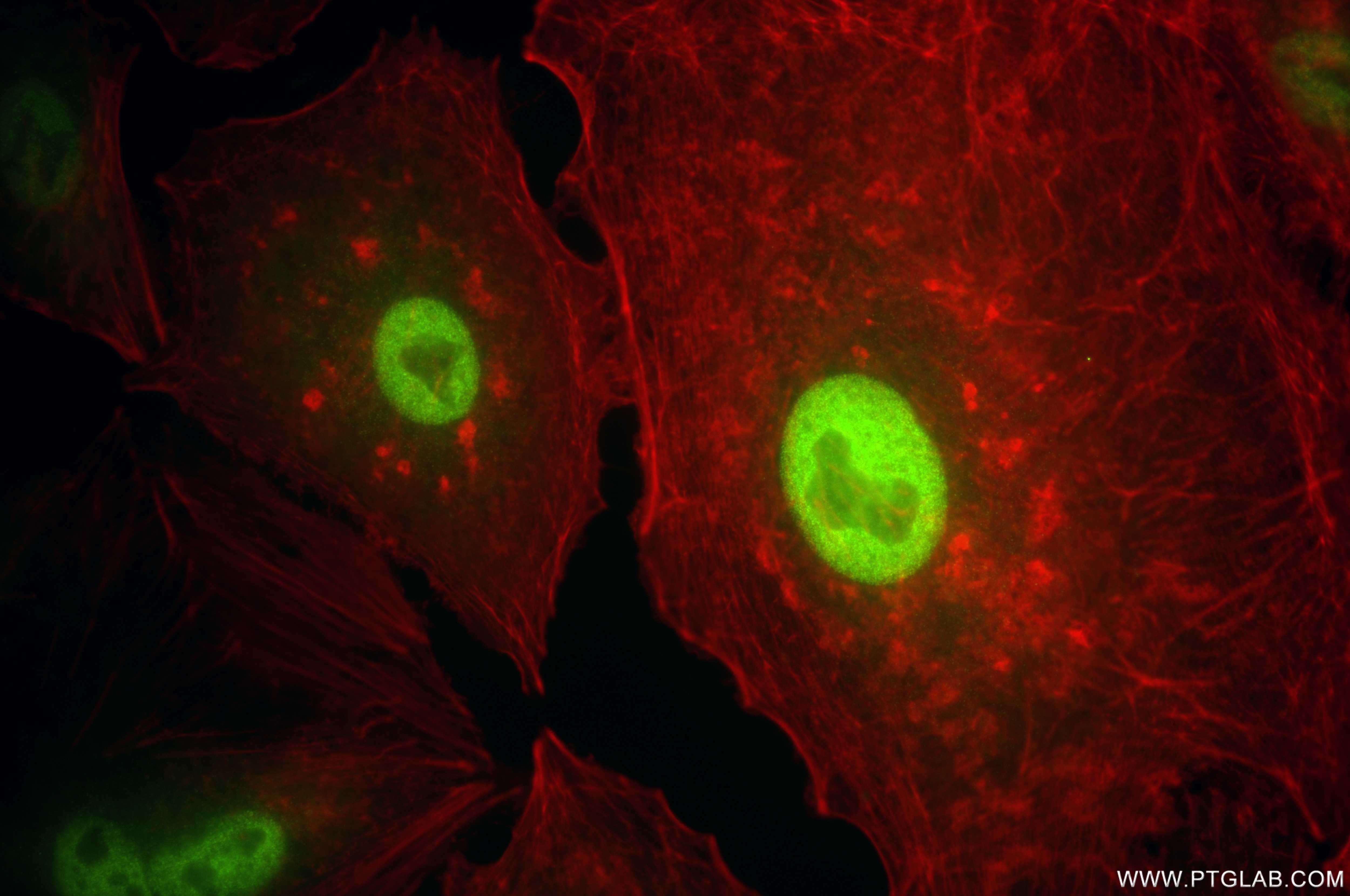 Immunofluorescence (IF) / fluorescent staining of A549 cells using PSMD3 Recombinant antibody (84928-2-RR)