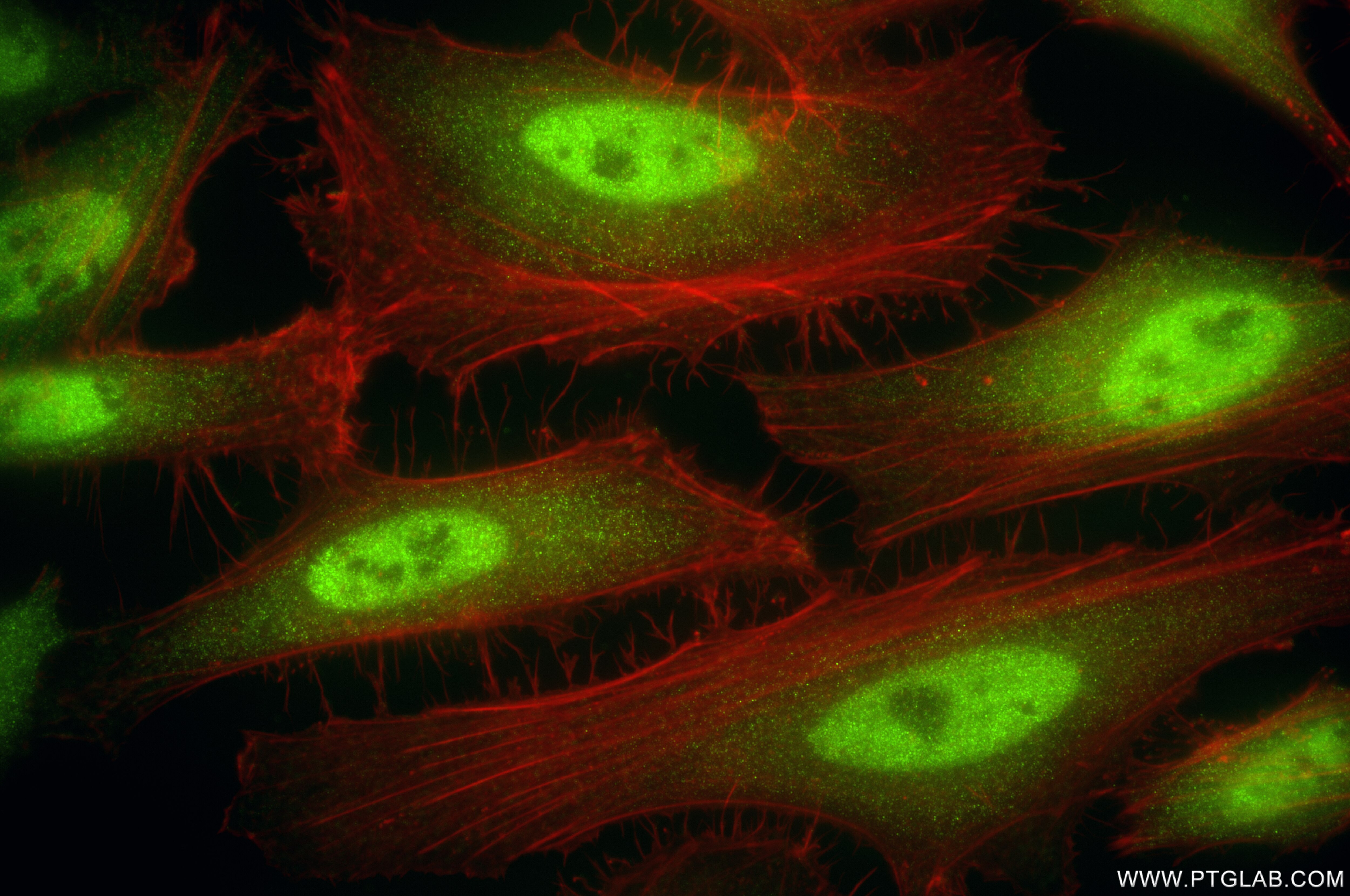 Immunofluorescence (IF) / fluorescent staining of HeLa cells using PSMD3 Recombinant antibody (84928-2-RR)