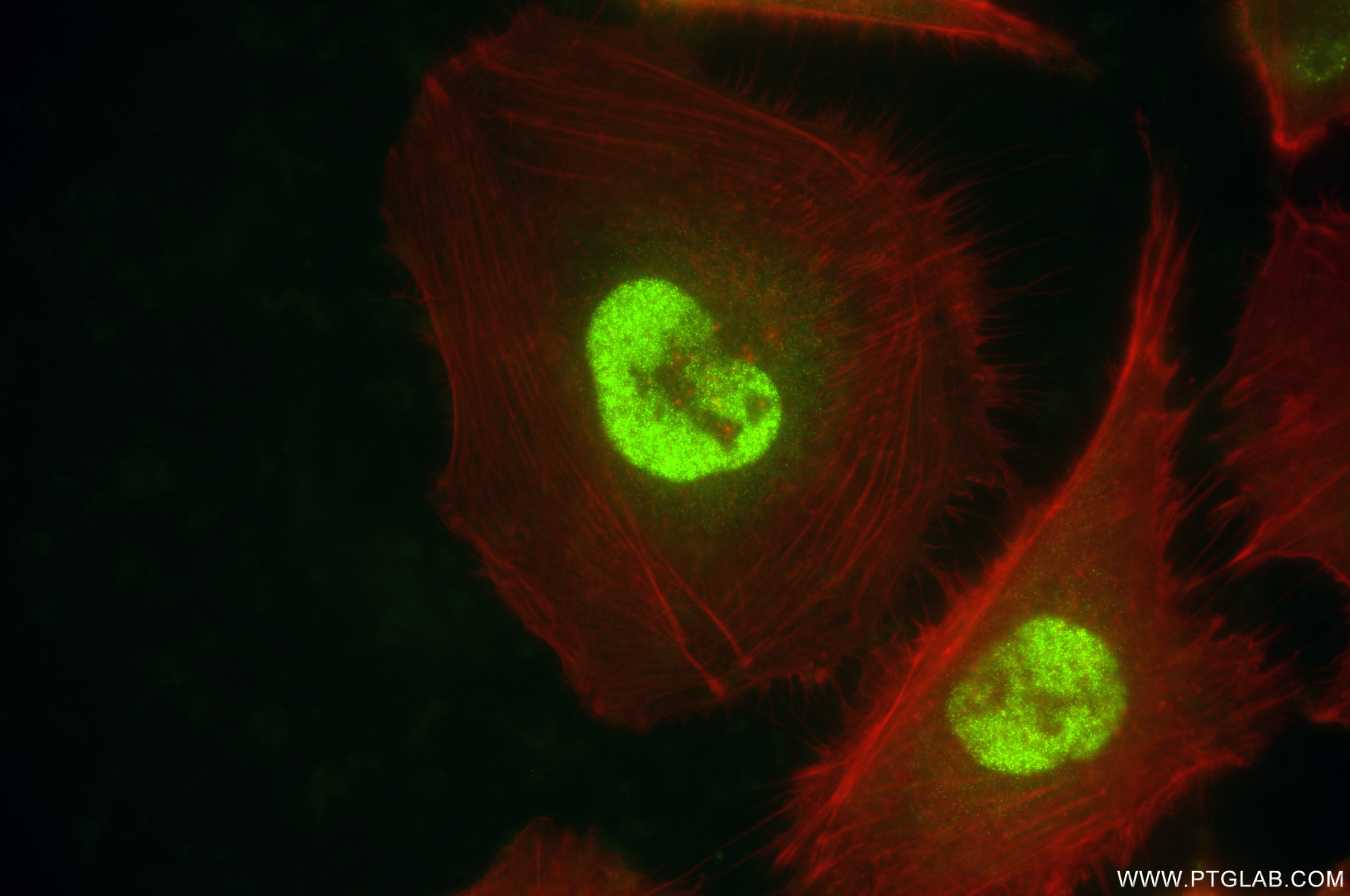 Immunofluorescence (IF) / fluorescent staining of U-251 cells using PSMD3 Recombinant antibody (84928-2-RR)