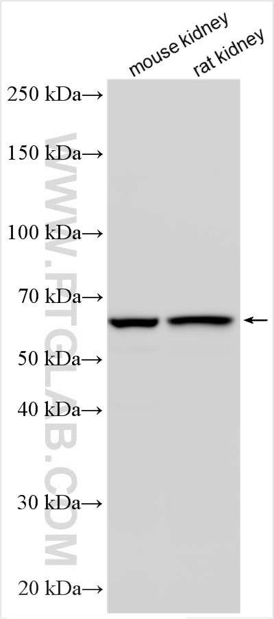 Western Blot (WB) analysis of various lysates using PSMD3 Recombinant antibody (84928-2-RR)