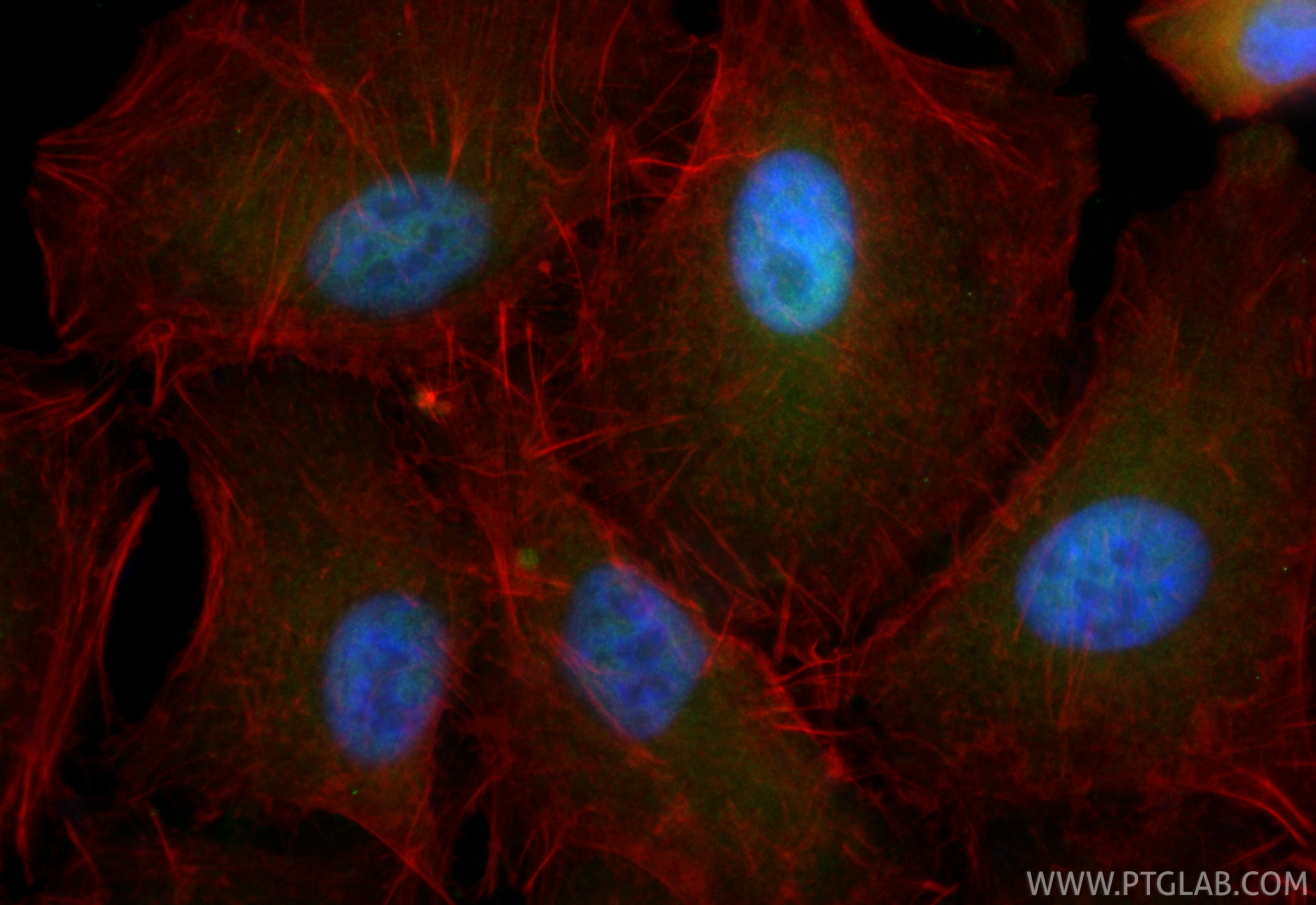 Immunofluorescent analysis of (4% PFA) fixed A549 cells using CoraLite® Plus 488 PSMD3 antibody (CL488-84928-2, Clone: 242470D4 ) at dilution of 1:200, CL594-Phalloidin (red). Immunofluorescence (IF) / fluorescent staining of A549 cells using CoraLite® Plus 488-conjugated PSMD3 Recombinant mo (CL488-84928-2)