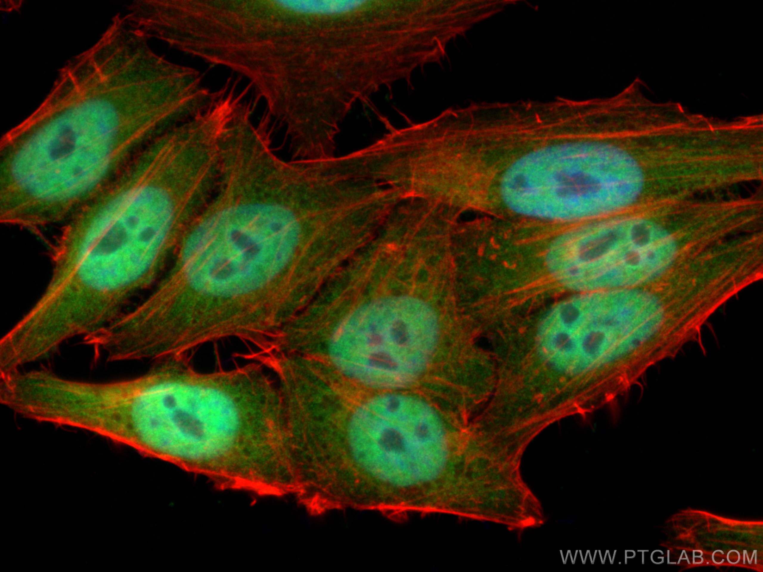 Immunofluorescence (IF) / fluorescent staining of HepG2 cells using PSMD4 Polyclonal antibody (14899-1-AP)