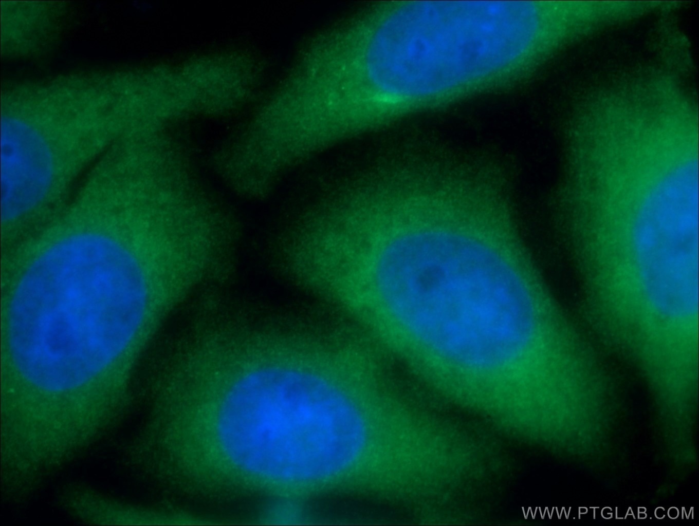 Immunofluorescence (IF) / fluorescent staining of HepG2 cells using PSMD4 Polyclonal antibody (14899-1-AP)