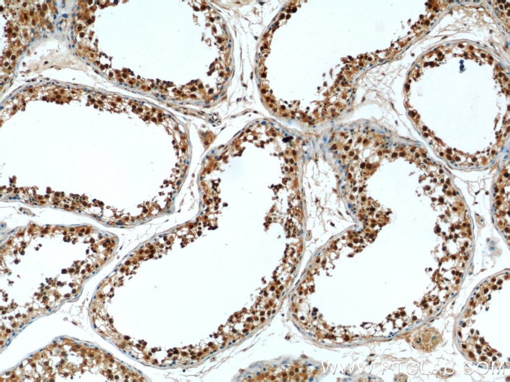 Immunohistochemistry (IHC) staining of human testis tissue using PSMD4 Polyclonal antibody (14899-1-AP)