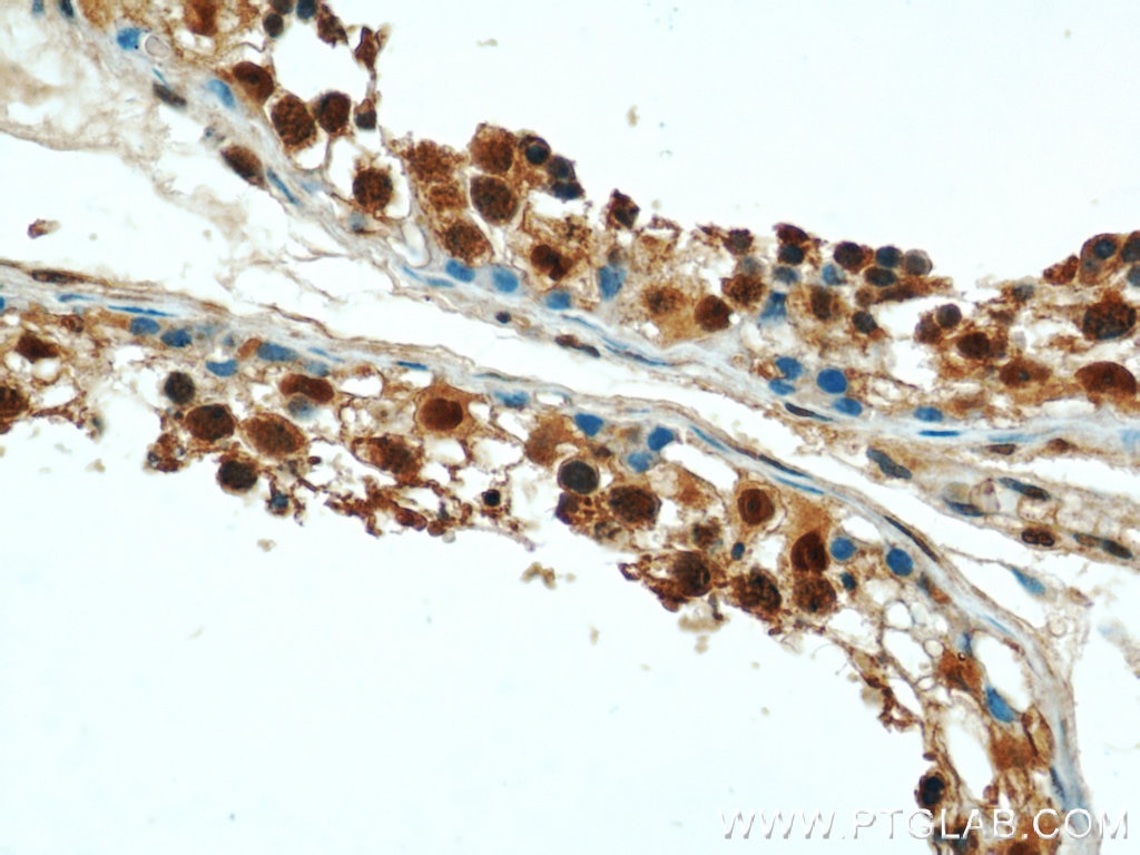 IHC staining of human testis using 14899-1-AP