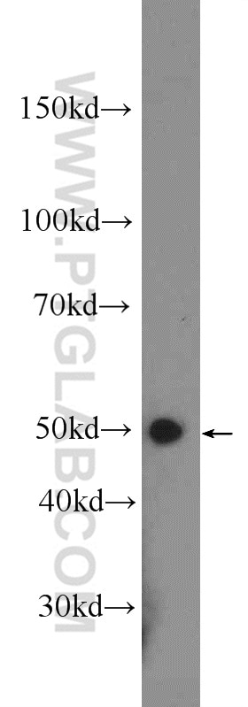 Western Blot (WB) analysis of rat spleen tissue using PSMD4 Polyclonal antibody (14899-1-AP)