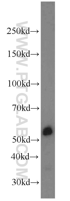 Western Blot (WB) analysis of K-562 cells using PSMD4 Polyclonal antibody (14899-1-AP)