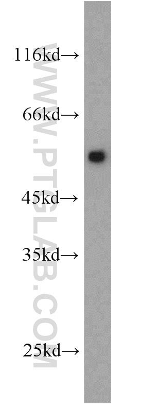 Western Blot (WB) analysis of HeLa cells using PSMD4 Polyclonal antibody (14899-1-AP)